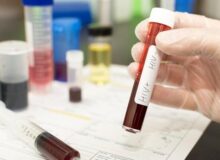 ماجرای افشای اطلاعات محرمانه بیماران HIV در آزمایشگاه‌های خصوصی