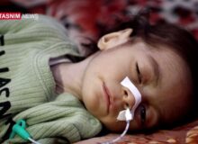 داستان تلخ پزشکان گرسنه در غزه و کودکانی که تبدیل به اسکلت شده‌اند