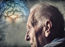 آلزایمر همیشه ارثی نیست!